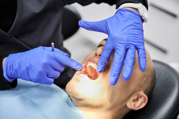 Best Emergency Root Canal Treatment in Hill N Dale, FL