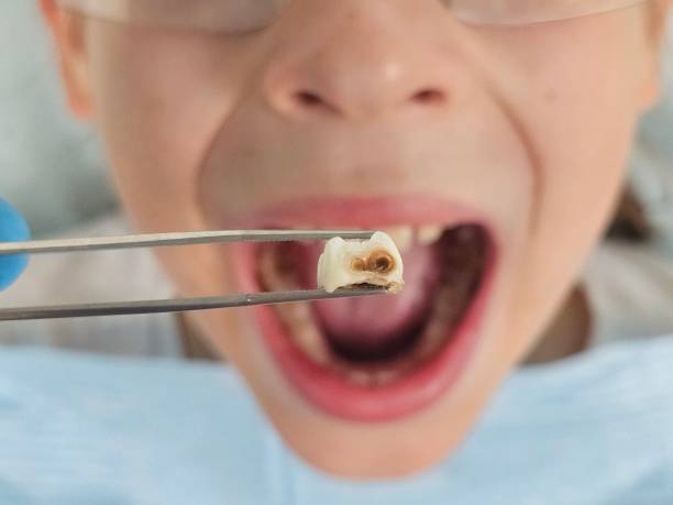 Best Pediatric Emergency Dentist in Hill N Dale, FL